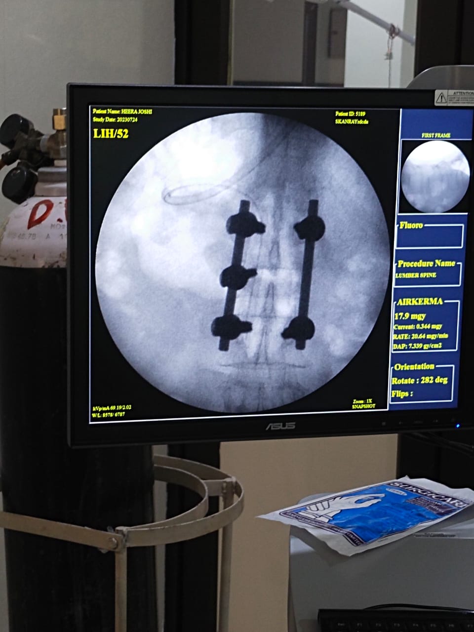जिला अस्पताल में 80 वर्षीय महिला के लंबर स्पाइन का हुआ सफल इलाज जिला अस्पताल में 80 वर्षीय महिला के लंबर स्पाइन का हुआ सफल इलाज