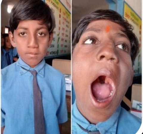 चिकित्सा के क्षेत्र में आयुष्मान और चिरायु योजना से नौनिहालों को मिल रहा जीवनदान चिकित्सा के क्षेत्र में आयुष्मान और चिरायु योजना से नौनिहालों को मिल रहा जीवनदान