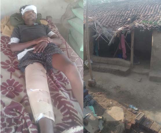 आयुष्मान योजना से बिरहोर आदिवासी युवक को मिला नया जीवन आयुष्मान योजना से बिरहोर आदिवासी युवक को मिला नया जीवन