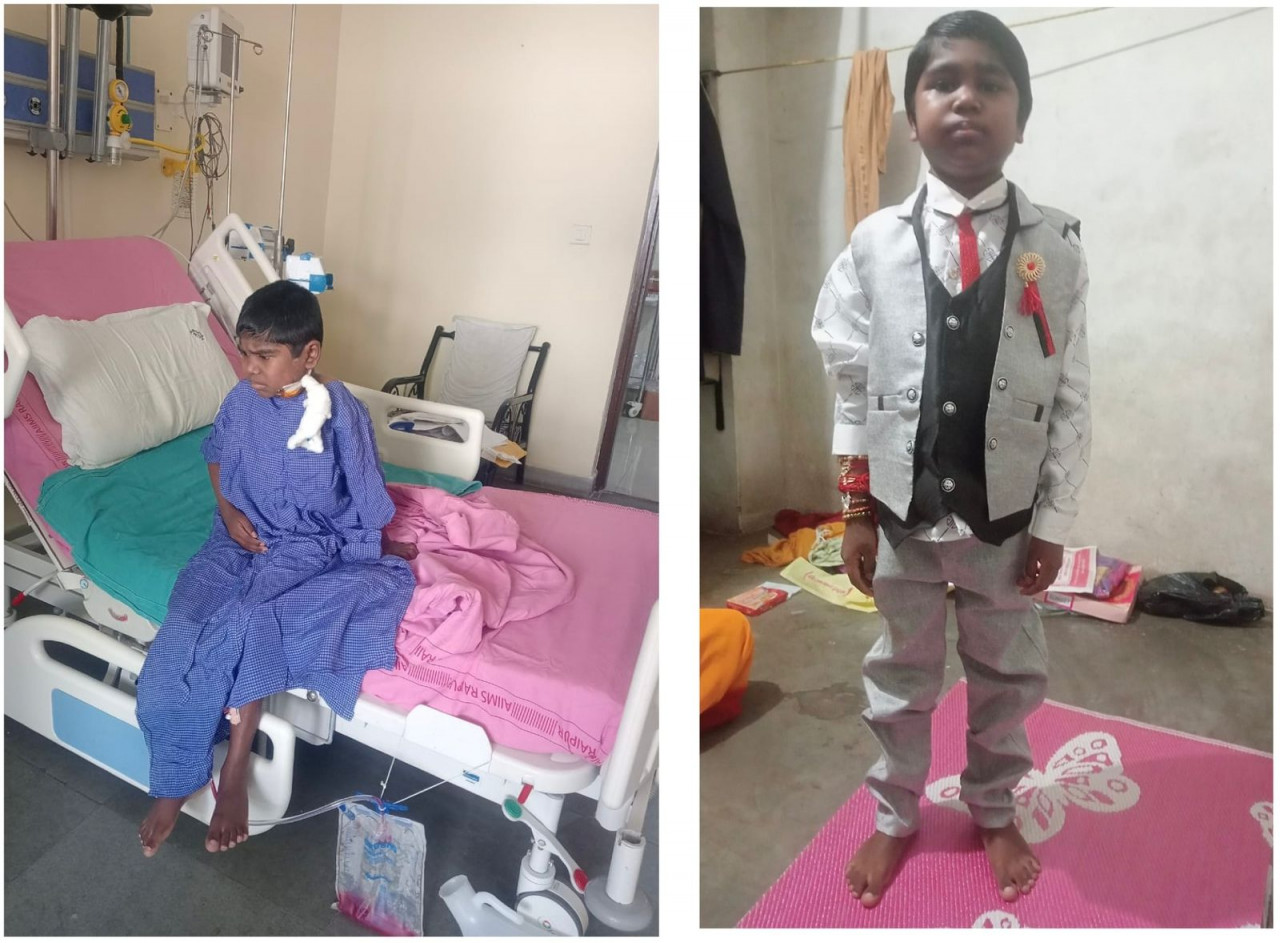 कृष्णा वर्मा के जीवन में मुख्यमंत्री विशेष स्वास्थ्य सहायता योजना का योगदान, चेहरे पर भी मुस्कान लौट आई कृष्णा वर्मा के जीवन में मुख्यमंत्री विशेष स्वास्थ्य सहायता योजना का योगदान, चेहरे पर भी मुस्कान लौट आई