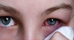  कंजक्टिवाइटिस : स्कूल शिक्षा और आदिम जाति तथा अनुसूचित जाति विकास विभाग को निर्देश जारी