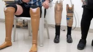  14 जून से 16 जून तक इंडोर स्टेडियम दंतेवाड़ा में होगा जयपुर फूट कैंप का आयोजन