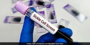 एक दिवसीय सिकल सेल जांच महाभियान 11 जुलाई को 