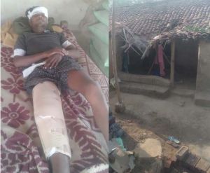 आयुष्मान योजना से बिरहोर आदिवासी युवक को मिला नया जीवन आयुष्मान योजना से बिरहोर आदिवासी युवक को मिला नया जीवन