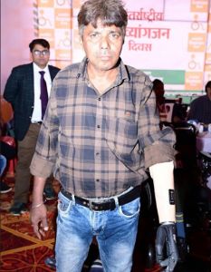  हादसे में मोहन ने गंवाई हाथ, अब कृत्रिम हाथों से काम होगा आसान