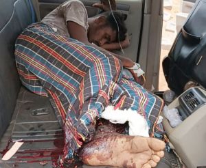 नक्सलियों के लगाए आईईडी के चपेट में आने से हाईवा चालक घायल नक्सलियों के लगाए आईईडी के चपेट में आने से हाईवा चालक घायल