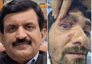 प्रदेश में भी कार्बाइड गन के प्रयोग पर बैन लगाया जाए- डॉ दिनेश मिश्र प्रदेश में भी कार्बाइड गन के प्रयोग पर बैन लगाया जाए- डॉ दिनेश मिश्र