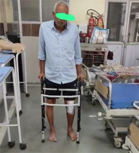  सिम्स में हुआ एक और हाई रिस्क मरीज का सफल घुटना प्रत्यारोपण