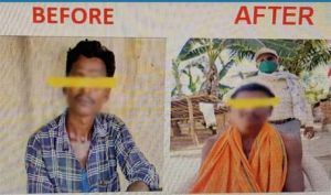    कुष्ठ रोग का समय पर हुआ इलाज - अब मरीज सम्मानजनक जीवन जी रहे है
