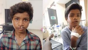  'चिरायु' दल ने लौटाई मुस्कान, जन्मजात कटे होंठ और तालु से मिली मुक्ति