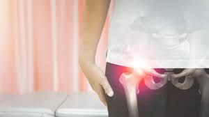 सर्दियों में क्यों जाम होने लगते हैं आपके कूल्हे? 