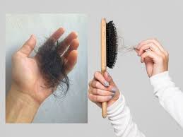 सर्दियों के मौसम में क्यों झड़ते हैं बाल सर्दियों के मौसम में क्यों झड़ते हैं बाल