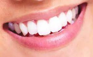 खूबसूरत दांतों को सड़ने से बचाएं, झटपट अपना लें 6 जरूरी टिप्स