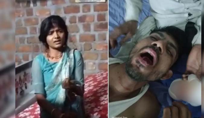 पति की जीभ काटने के आरोप में महिला के खिलाफ प्राथमिकी दर्ज पति की जीभ काटने के आरोप में महिला के खिलाफ प्राथमिकी दर्ज