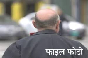 गंजे युवक ने विग लगाकर की शादी! राज खुला तो पत्नी ने मांगा तलाक