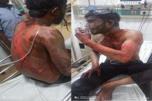 युवती  ने प्रेमी पर फेंका तेजाब! इलाज के दौरान मौत