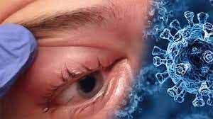  ब्लैक फंगस के कारण 30 लोगों की एक आंख की रोशनी गई