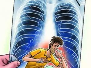   कोरोना वायरस संक्रमण से पैदा हो सकता है टीबी का खतरा : स्वास्थ्य मंत्रालय