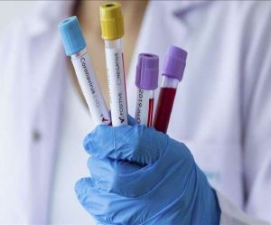   भारत आने वाले सात देशों के यात्रियों के लिए आरटी-पीसीआर जांच अनिवार्य