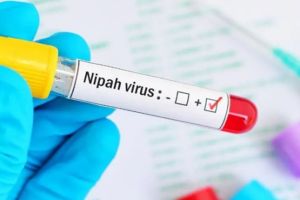   निपाह वायरस  : केंद्र ने केरल सरकार जन स्‍वास्‍थ्‍य उपायों को तत्‍काल लागू करने की सलाह दी