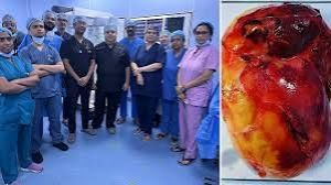 सफदरजंग अस्पताल के चिकित्सकों ने रोबोटिक सर्जरी के जरिए &lsquo;एड्रेनल ट्यूमर' को हटाया