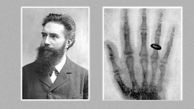 X-Ray की खोज कैसे हुई? जानें शरीर के अंदर देखने वाली इस तकनीक का इतिहास X-Ray की खोज कैसे हुई? जानें शरीर के अंदर देखने वाली इस तकनीक का इतिहास
